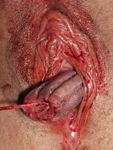 Pussy Bleeding From Large Cock
